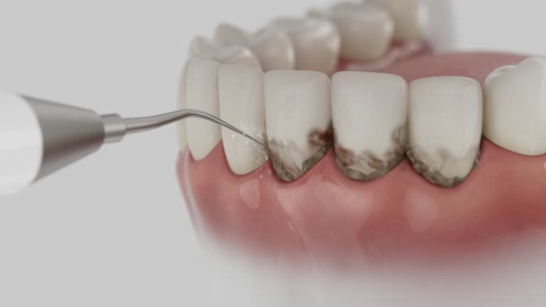 Reliable Dental contractor in Palacios, TX by Smile Center Dentistry